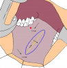 mucosa-orale-01