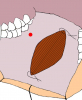 mucosa-orale-03