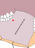 mucosa-orale-04