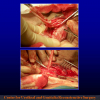 Diapositiva54