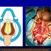 Diapositiva66