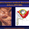 Diapositiva06