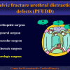 Diapositiva09