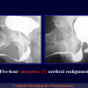 Diapositiva38
