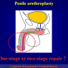 Diapositiva05