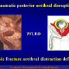 Diapositiva03