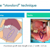 Diapositiva08