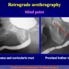 Diapositiva08