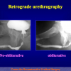 Diapositiva14