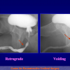 Diapositiva19