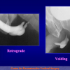 Diapositiva20