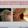 Diapositiva011