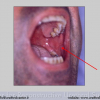 Diapositiva018