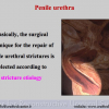 Diapositiva038