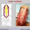 Diapositiva046