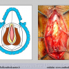 Diapositiva082