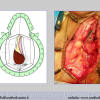 Diapositiva098