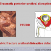 Diapositiva04