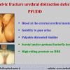 Diapositiva11