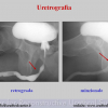 Diapositiva07