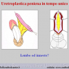 Diapositiva21