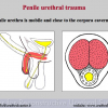 Diapositiva06