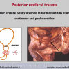 Diapositiva15