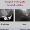 Diapositiva11