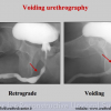 Diapositiva12