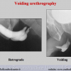 Diapositiva13