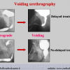 Diapositiva14