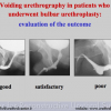 Diapositiva15