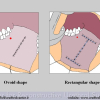 Diapositiva104