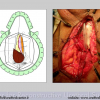 Diapositiva91