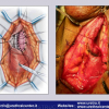 Diapositiva085
