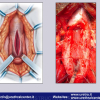 Diapositiva33