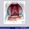 Diapositiva38