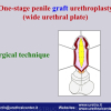 Diapositiva09