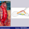 Diapositiva18