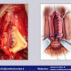 Diapositiva72