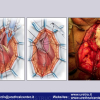 Diapositiva83