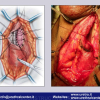 Diapositiva85
