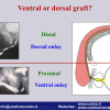 Diapositiva070