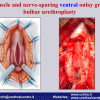 Diapositiva072