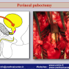 Diapositiva34