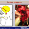 Diapositiva35