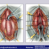 Diapositiva89