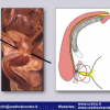 Diapositiva46