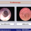 Diapositiva36