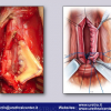 Diapositiva39